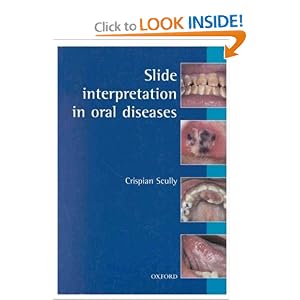 Click here to buy Slide Interpretation in Oral Diseases (Oxford Medical Publications) by Crispian Scully.