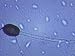 Aspergillus Conidiospores Conidia Asexual Spores Photographic Poster Print, 16x12