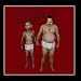 The Scabs-Scabs On Strike II: Just Friends