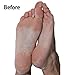 Foot Pedicure Machine By JTrim FinePedi Micro Pedi Electric Callus Remover For Feet Care Foot File Shaver Tool Include Travel Case Ladies in Pink JPT-CR200 Jay's Products