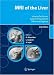 MRI of the Liver: Imaging Techniques, Contrast Enhancement, Differential Diagnosis
