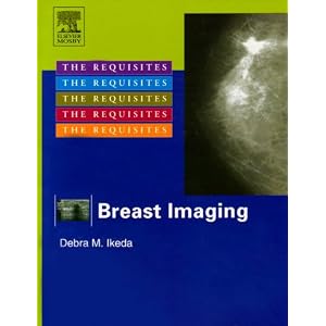 Click here to buy Breast Imaging: The Requisites (Requisites in Radiology) by Debra Ikeda.