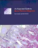 An Illustrated Guide to Bone Marrow Diagnosis