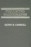 Evaluating Radiographs