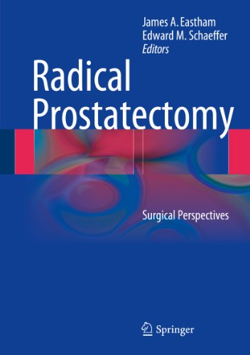 Radical Prostatectomy: Surgical Perspectives