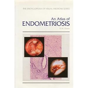 An Atlas of Endometriosis