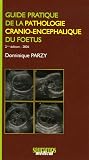 Guide pratique de la pathologie cranio-enc�phalique du foetus