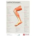 Laufverletzungen: Laufverletzungen sind ein h�ufiges, aber vermeidbares Problem. Oftmals entstehen sie durch Fehler in Technik und Ausr�stung, die Sie gut beeinflussen k�nnen