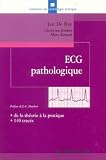 ECG pathologique : De la th�orie � la pratique, 140 trac�s