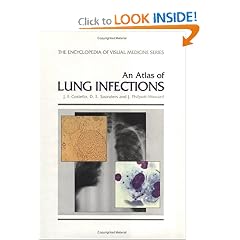 An Atlas of Lung Infections (Encyclopedia of Visual Medicine) by J.F. Costello and Dawn E. Saunders