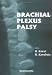 Brachial Plexus Palsy