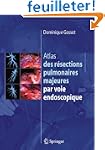 Atlas des r�sections pulmonaires maje...