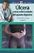 Book Ulcera y otras enfermedades del aparato digestivo: Prevencion, causas, cuidados (Medico en casa series)