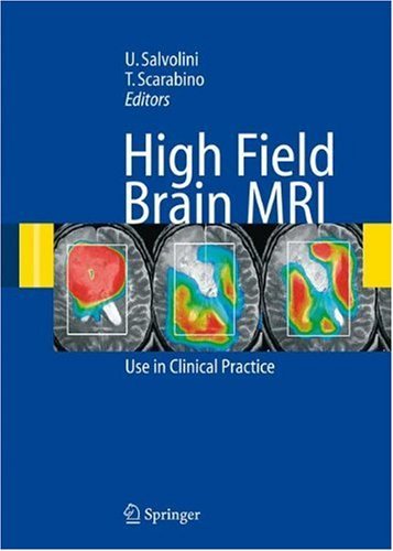 High Field Brain MRI: Use in Clinical Practice On Sale