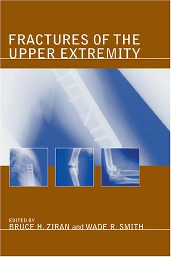 Image of Fractures of the Upper Extremity