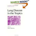 Lung Disease in the Tropics (Lung Biology in Health and Disease) by  Om P. Sharma