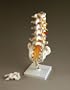 Flexible Lumbar Vertebral Column With Herniated Disc
