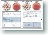 Blood Type Kits (2ea Eldoncard Test Kits)- Test Your Blood Type and Rh Factor at Home. Follow the Blood Type Diet