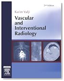 Vascular and Interventional Radiology, 2e