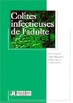 Colites infectieuses de l'adulte