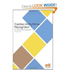 Cardiac Arrhythmia Recognition (Easy Learning Guide) by Fiona Foxhall