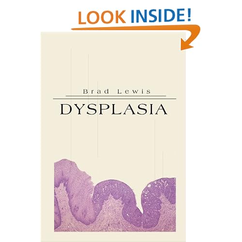 Dysplasia