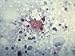 Rocky Mountain Spotted Fever Bacteria Rickettsiae in the Cytoplasm of the Host Cell Photographic Poster Print, 16x12