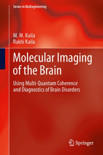 Molecular Imaging of the Brain: Using Multi-Quantum Coherence and Diagnostics of Brain Disorders (Series in BioEngineering)