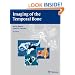 Imaging of the Temporal Bone