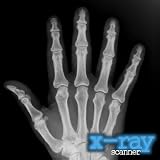 X-Ray Scanner