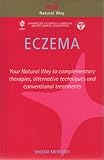 Eczema