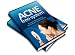 ACNE Free System - Proven Methods For Permanent Acne Control
