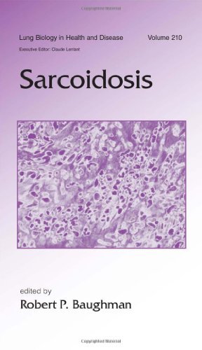 Sarcoidosis (Lung Biology in Health and Disease) On Sale