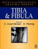 Tibia and Fibula (Musculoskeletal Trauma)