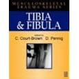Tibia and Fibula (Musculoskeletal Trauma)