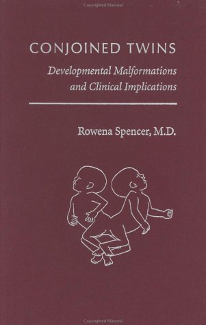 Conjoined Twins: Developmental Malformations and Clinical Implications