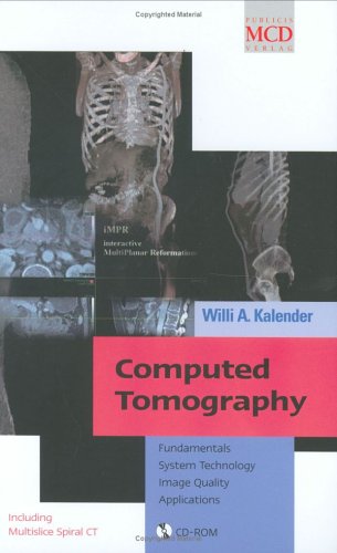 Computed-Tomography