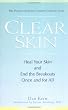 Clear Skin: Heal Your Skin and End the Breakouts- Once and for All
