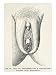 Female Circumcision is Practised in Africa Islam South America and Malaysia Giclee Poster Print, 18x24
