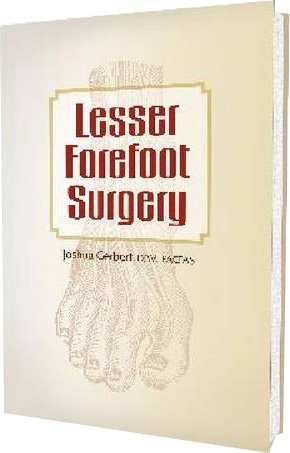 Lesser Forefoot Surgery
