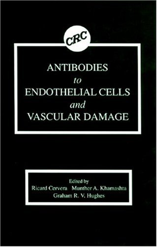 Vasculitis