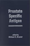 Prostate Specific Antigen