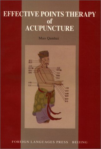 Acupuncture