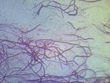 Streptomyces Species Gram Stain Photographic Poster Print, 40x30