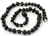 Baltic Amber Baby Teething Necklace Round Cherry Amber Beads