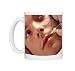 Anti-wrinkle injection Photo Mugs