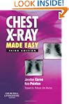 Chest X-Ray Made Easy, 3e
