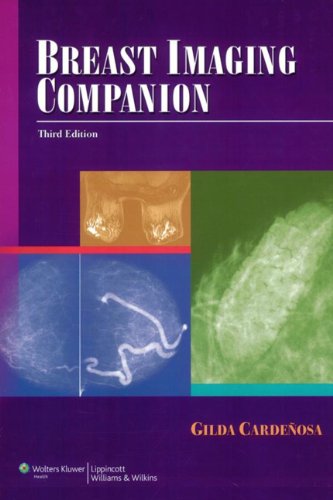 Breast Imaging Companion (Imaging Companion Series) Breast Imaging Companion (Imaging Companion Series)