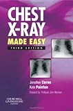 Chest X-Ray Made Easy (Made Easy Series)