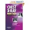 Chest X-Ray Made Easy, 3e